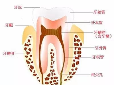 什么是根管治疗 为什么要做根管治疗
