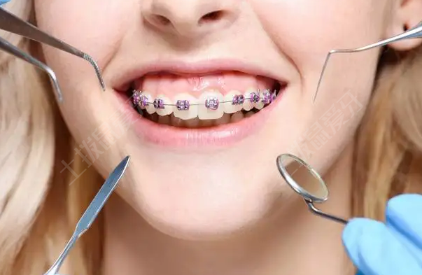 戴牙套得遗疡怎么办 戴牙套后多久复诊一次