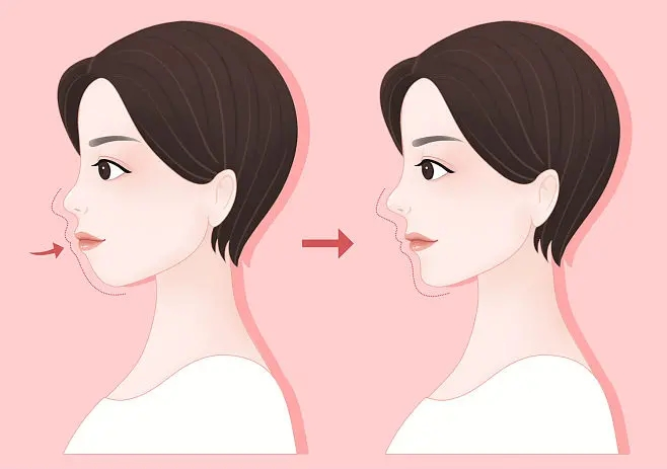 面形不美观需要看什么医生