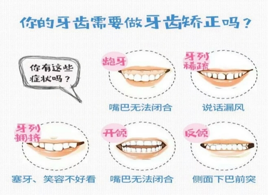 哪些牙科畸形或缺陷需要美容 牙体缺损应该修复治疗