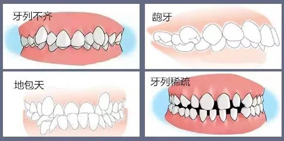 牙齿长得不齐是由什么原因引起的 如何防治