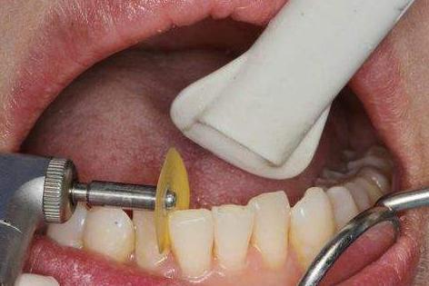 拔牙会痛吗 拔牙后应注意哪些事项