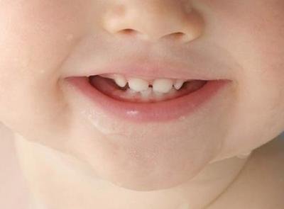 儿童的牙齿如何保护