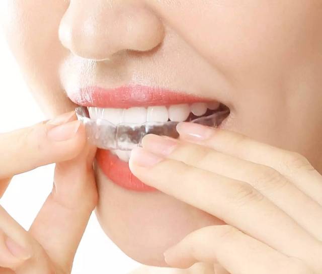 隐形矫正适合哪些人群