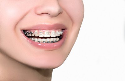 牙齿矫正出现反弹的原因是什么