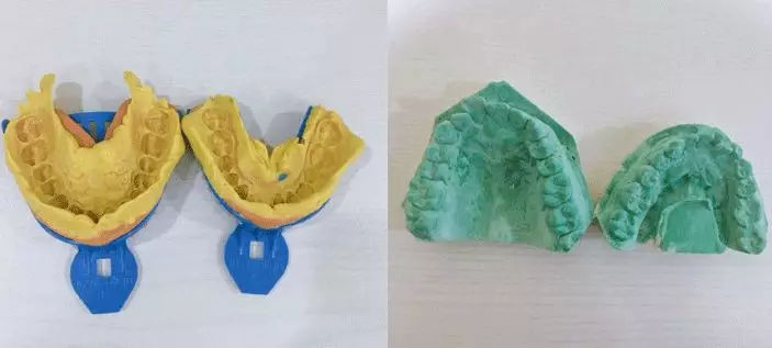牙颌模型检查的作用是什么
