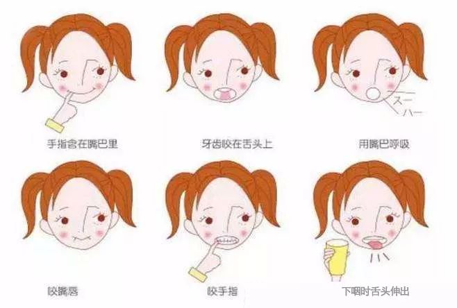 预防性矫治的方法有哪些