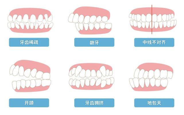 牙齿不齐是怎样造成的