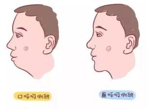 口呼吸习惯是什么原因造成的 口呼吸如何预防