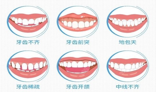 儿童正畸的基本流程是怎样的