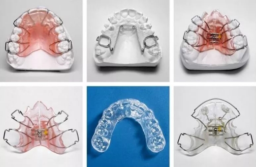 正畸后的保持器有几种 选用什么样的保持器比较好