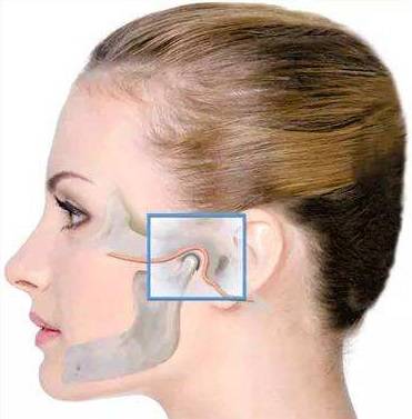 什么是颞下颌关节紊乱 导致颞下颌关节紊乱的因素有哪些