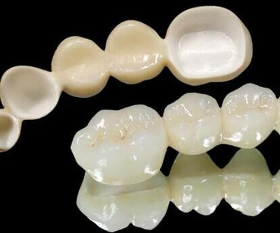 人工牙的种类有几种 戴活动义齿会影响邻牙的健康吗