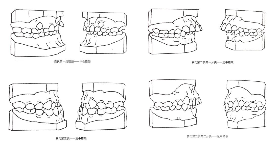 错颌畸形对颌面部有什么影响
