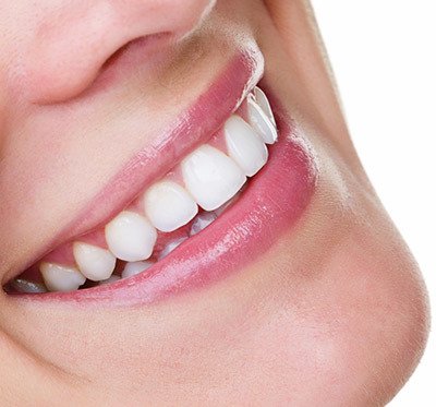 口腔正畸学中的审美艺术是什么