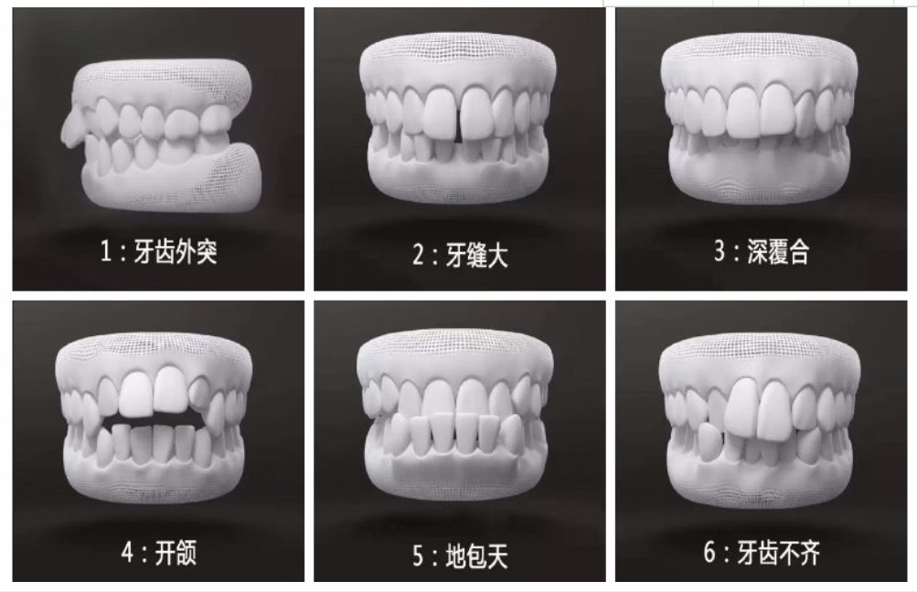 如何建立良好的颌关系