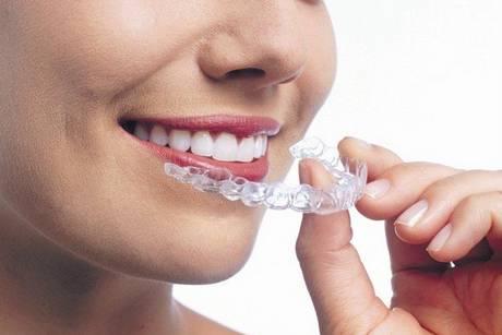 隐适美是什么 隐适美牙套有什么系列