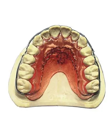 什么叫贝格矫治器 什么叫口外矫治器