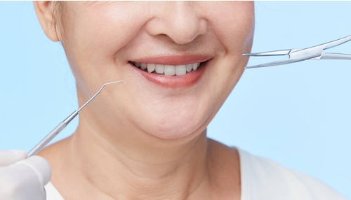 中年人护齿的要点是什么