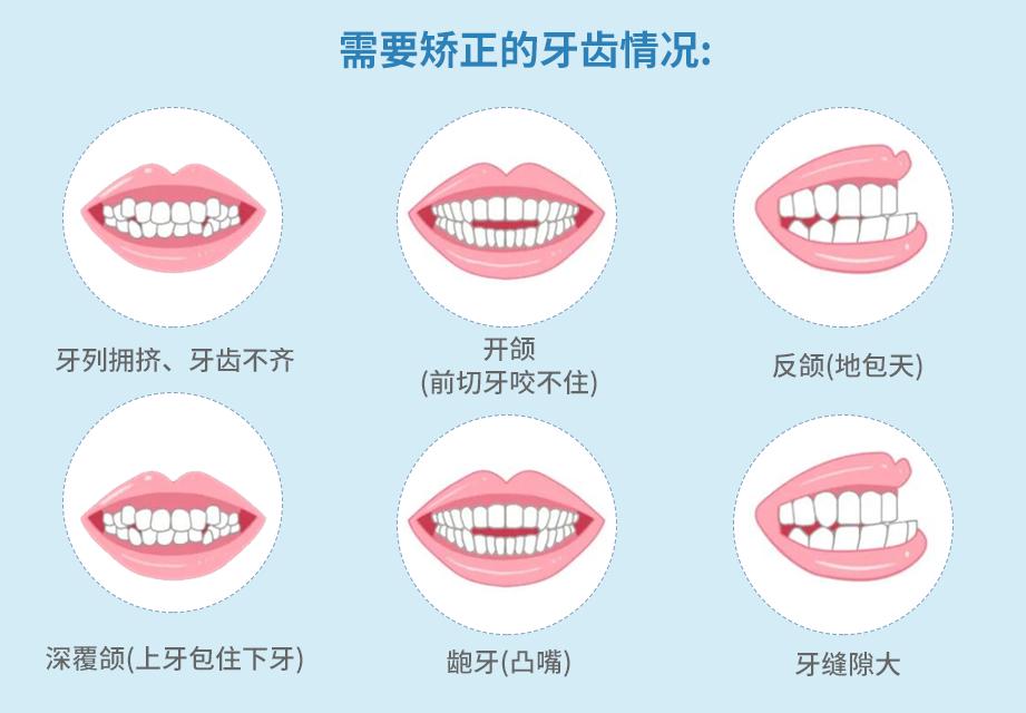 什么是牙颌畸形