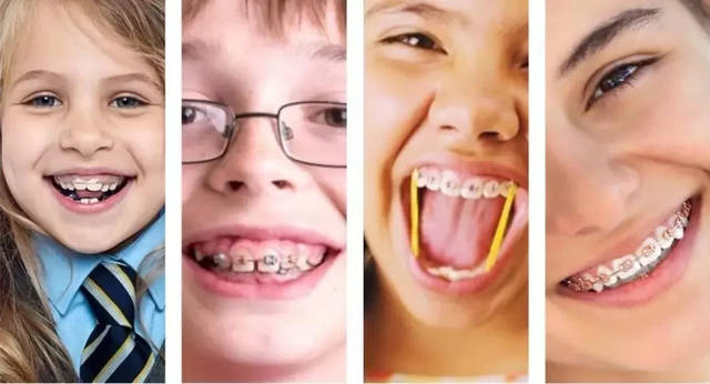 换完牙再进行牙齿矫正会晚了吗