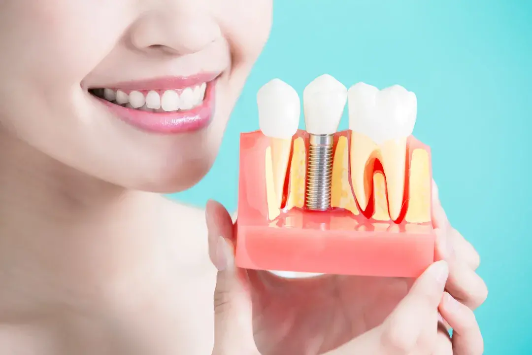 牙种植体按其种植部位的不同分哪几类
