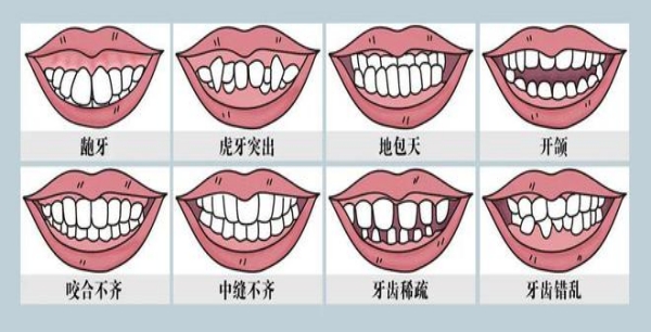 错颌畸形可不可以预防