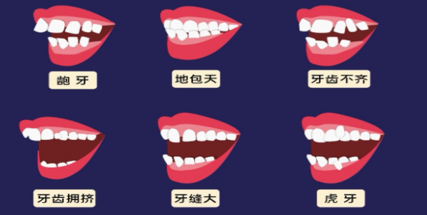 错颌畸形的发病率是怎么样的