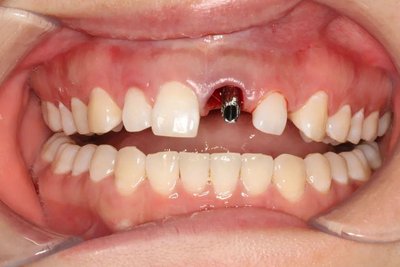 牙痛有哪些种类 治疗原则如何