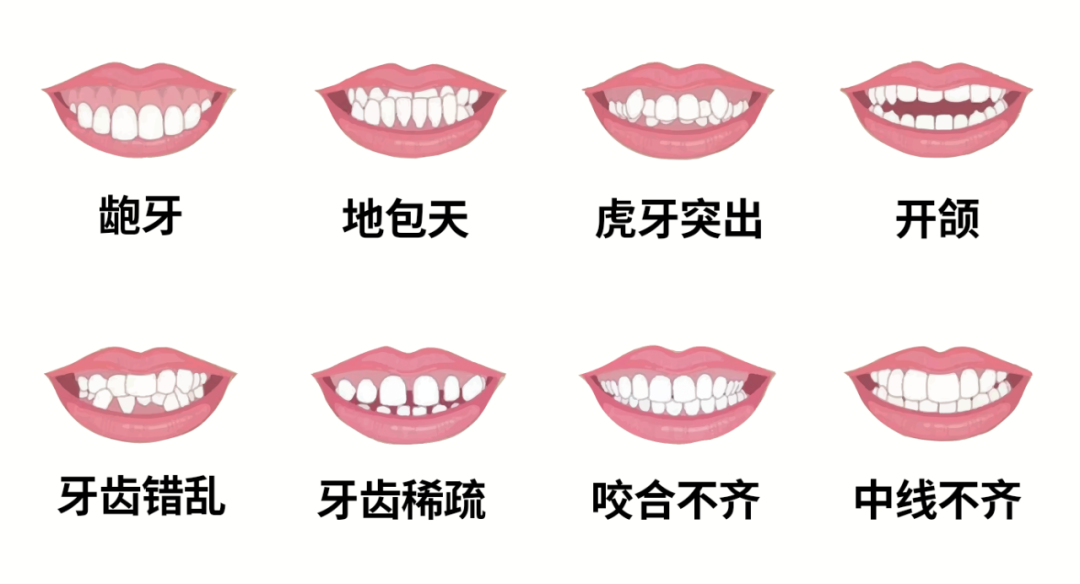 成人也可矫正牙颌畸形吗