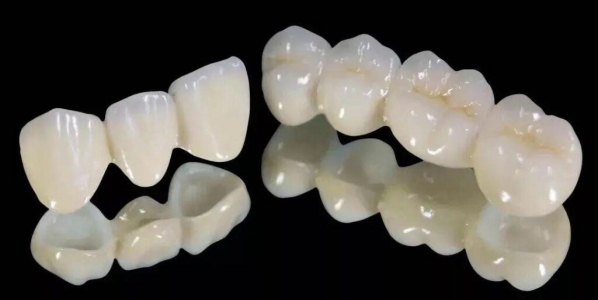 烤瓷牙固定修复的注意事项