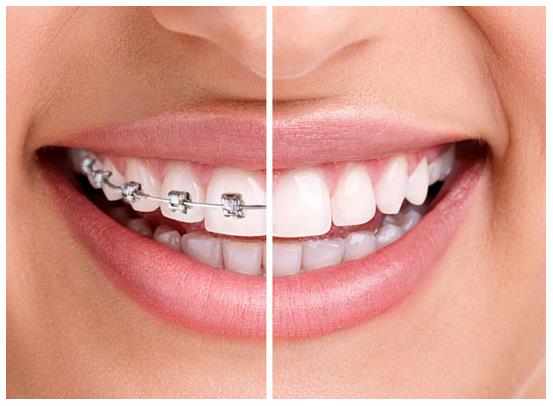 成年人矫治存在什么不确定因素