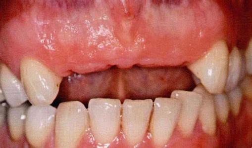 什么是口腔修复学