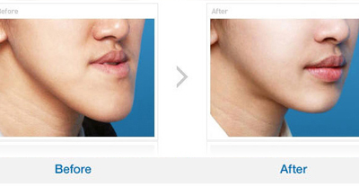 错颌畸形治疗后的稳定性