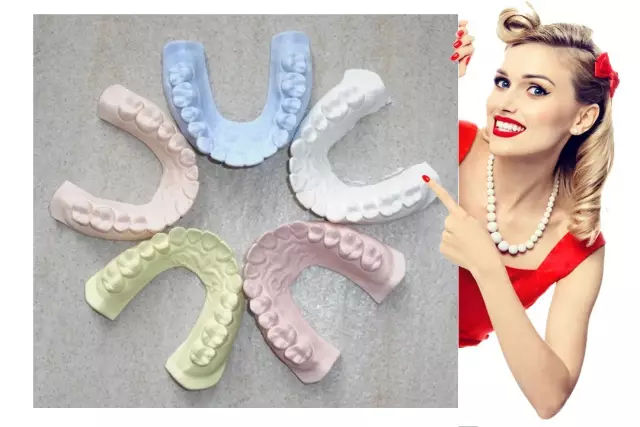 矫治牙颌畸形时为什么要做石膏牙颌模型