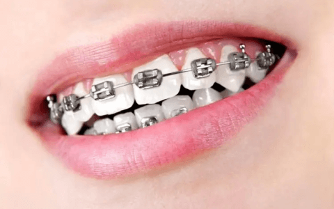 牙颌畸形中的先天因素是什么