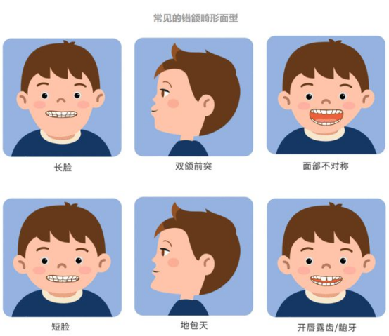 先天性牙颌畸形的症状