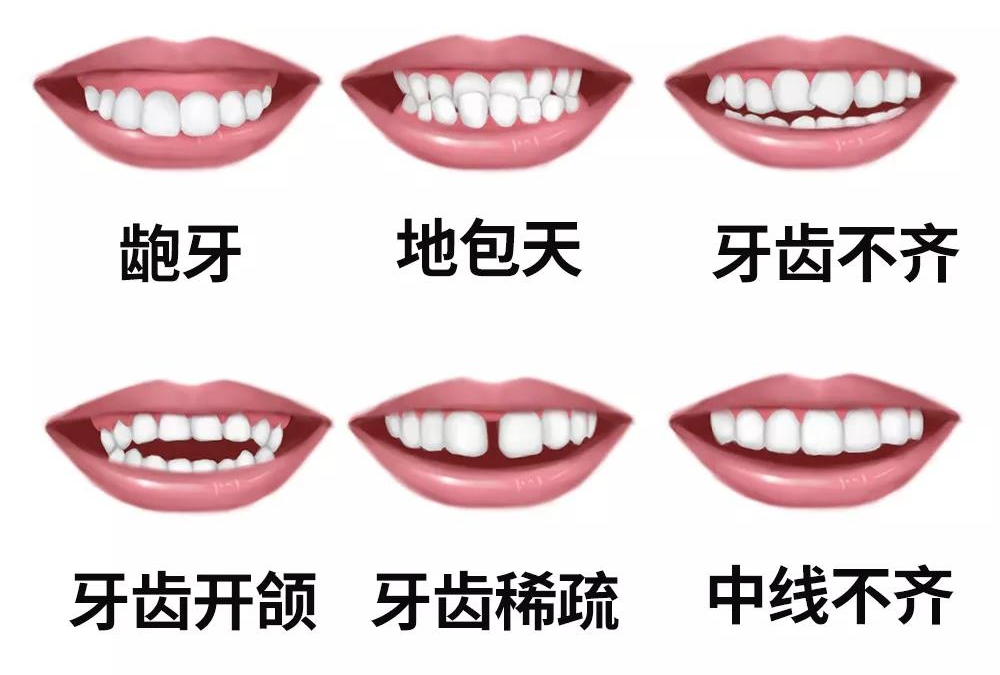 外科正畸的原则和治疗程序是怎么样的