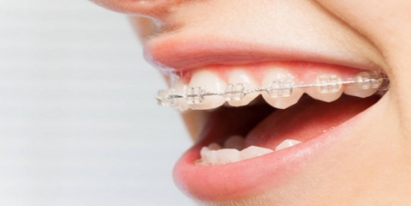牙颌畸形的矫治目标是什么