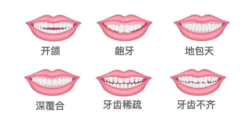 牙颌畸形与正畸治疗