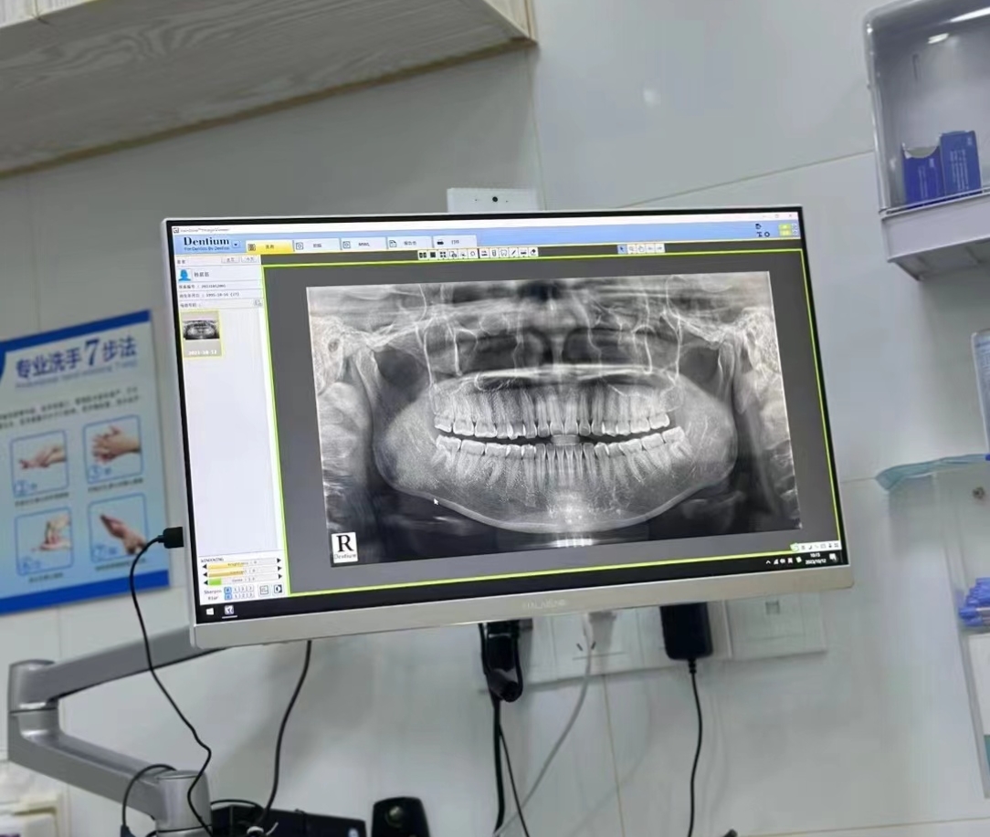 诊断错颌畸形有哪些特殊检查