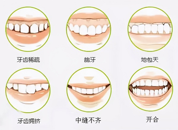 错颌畸形的治疗方法