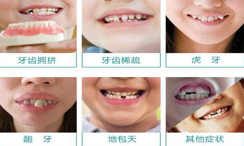 为什么有些错颌畸形病人需要拔牙
