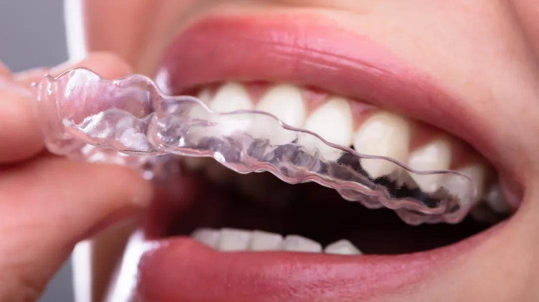 什么叫活动矫治器