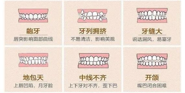 错颌畸形复发的原因是什么