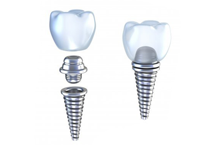 种植牙的并发症有什么