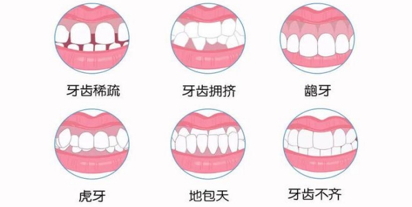 牙齿矫正的须知有哪些