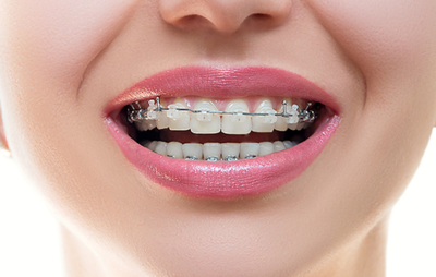 牙齿矫治牙移动的机理是什么