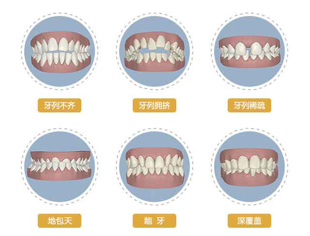 功能矫治后复发的主要原因