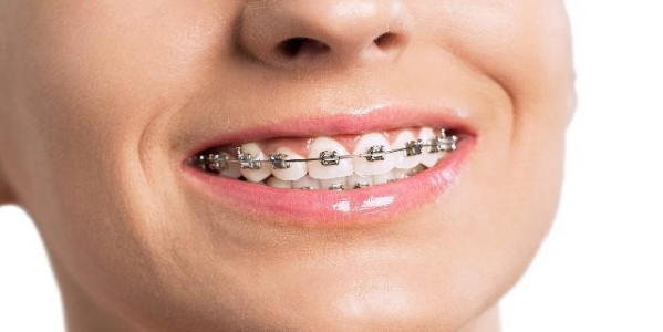 正畸矫治前对患者的要求